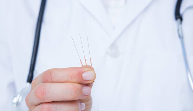 طب سوزنی خطر سکته مغزی را کاهش می‌دهد؟