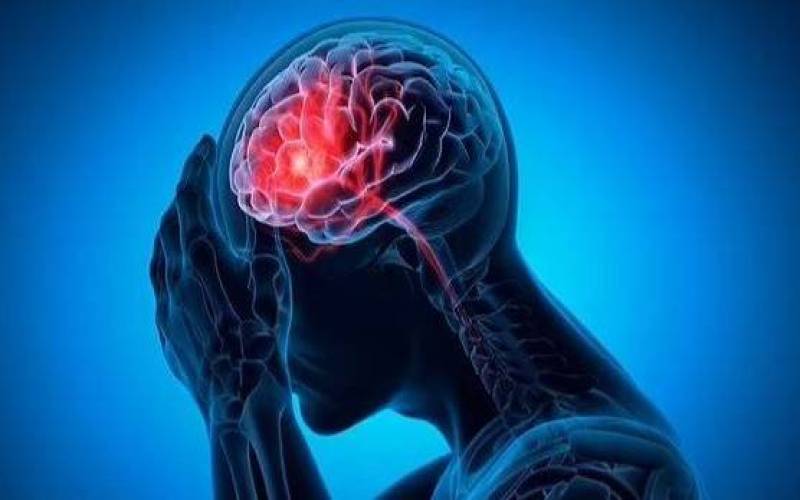 نشانه‌های مهم سکته مغزی را بشناسید