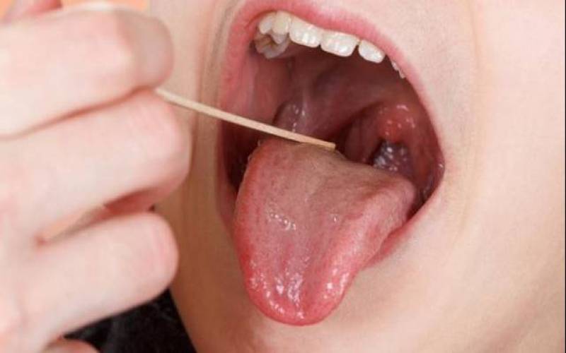 نقش لوزه‌ها در سیستم ایمنی بدن